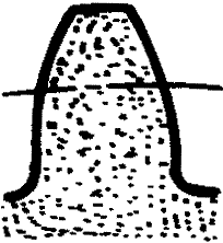 �X݆�����g(sh��)�Z(y��)һ�㶨�x