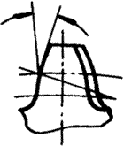 �X݆�����g(sh��)�Z�A���X݆�͈A���X݆��